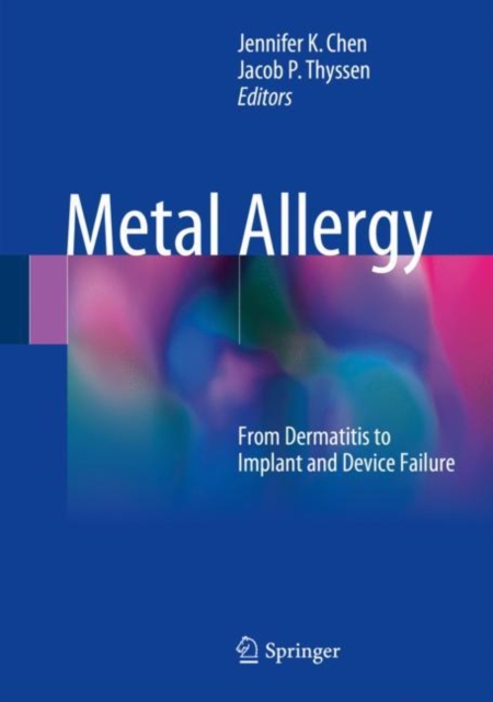 Metal Allergy : From Dermatitis to Implant and Device Failure, Hardback Book