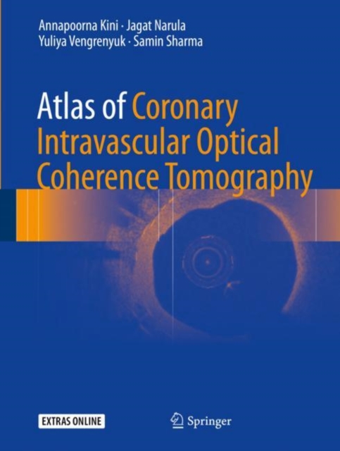 Atlas of Coronary Intravascular Optical Coherence Tomography, EPUB eBook