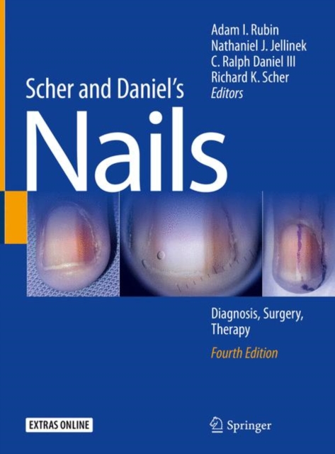Scher and Daniel's Nails : Diagnosis, Surgery, Therapy, Hardback Book