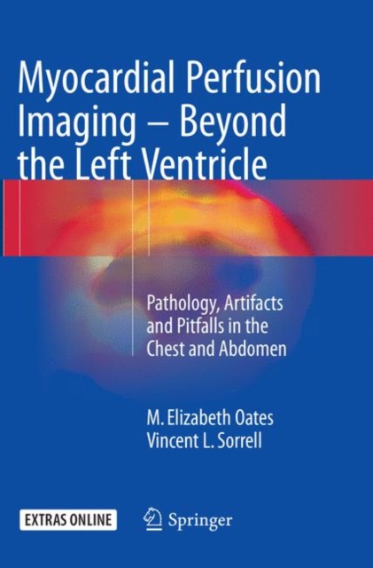 Myocardial Perfusion Imaging - Beyond the Left Ventricle : Pathology, Artifacts and Pitfalls in the Chest and Abdomen, Paperback / softback Book