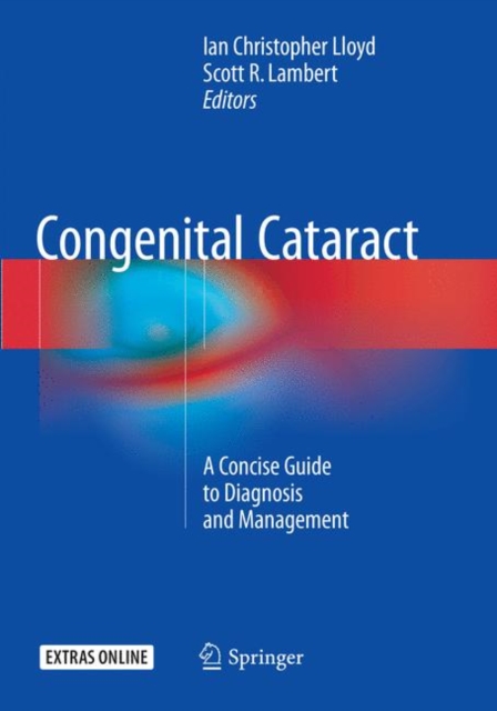 Congenital Cataract : A Concise Guide to Diagnosis and Management, Paperback / softback Book