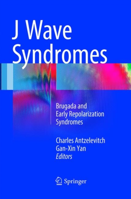 J Wave Syndromes : Brugada and Early Repolarization Syndromes, Paperback / softback Book