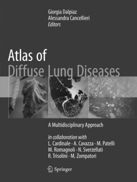 Atlas of Diffuse Lung Diseases : A Multidisciplinary Approach, Paperback / softback Book