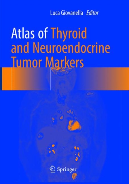 Atlas of Thyroid and Neuroendocrine Tumor Markers, Paperback / softback Book