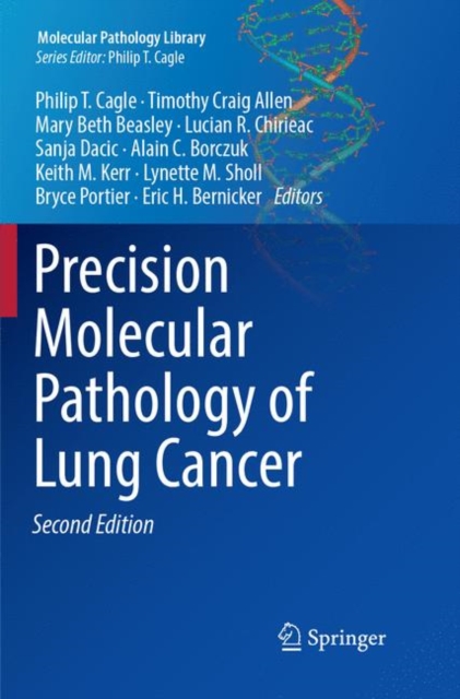 Precision Molecular Pathology of Lung Cancer, Paperback / softback Book
