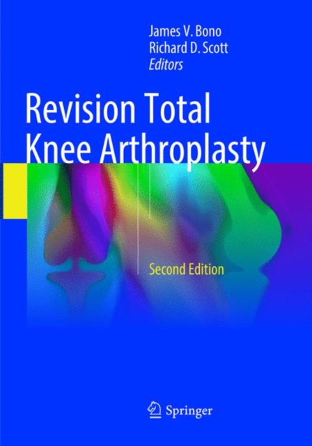 Revision Total Knee Arthroplasty, Paperback / softback Book