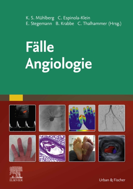 Falle Angiologie, EPUB eBook