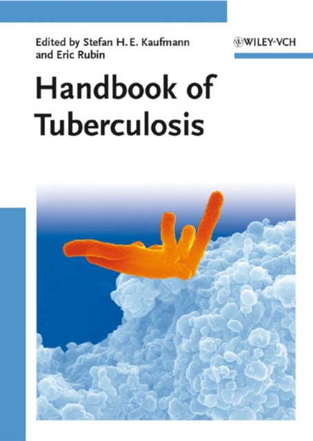 Handbook of Tuberculosis, 3 Volume Set, Hardback Book