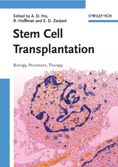 Stem Cell Transplantation : Biology, Processes, and Therapy, PDF eBook