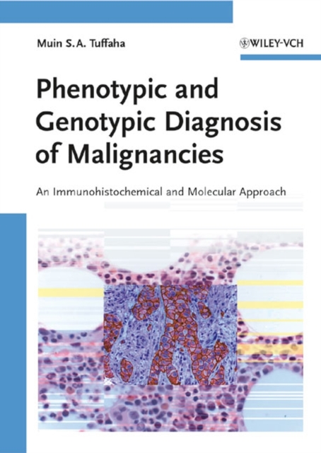 Phenotypic and Genotypic Diagnosis of Malignancies : An Immunohistochemical and Molecular Approach, PDF eBook