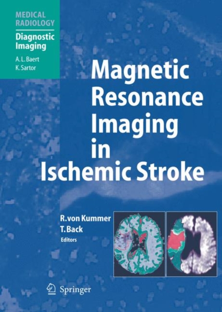Magnetic Resonance Imaging in Ischemic Stroke, Hardback Book