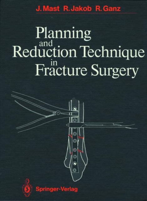 Planning and Reduction Technique in Fracture Surgery, Hardback Book