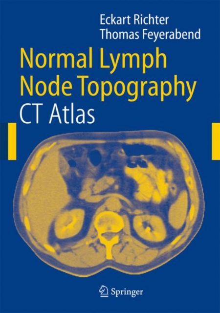 Normal Lymph Node Topography : CT Atlas, Paperback / softback Book