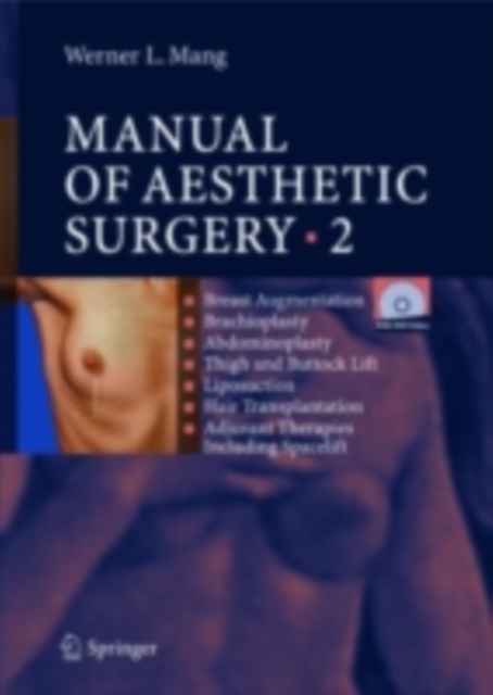 Manual of Aesthetic Surgery 2 : Breast Augmentation; Brachioplasty; Abdominoplasty; Thigh and Buttock Lift; Liposuction; Hair Transplantation; Adjuvant Therapies including Space Lift, PDF eBook