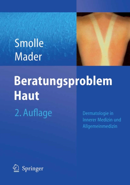 Beratungsproblem Haut : Dermatologie in Innerer Medizin und Allgemeinmedizin, PDF eBook