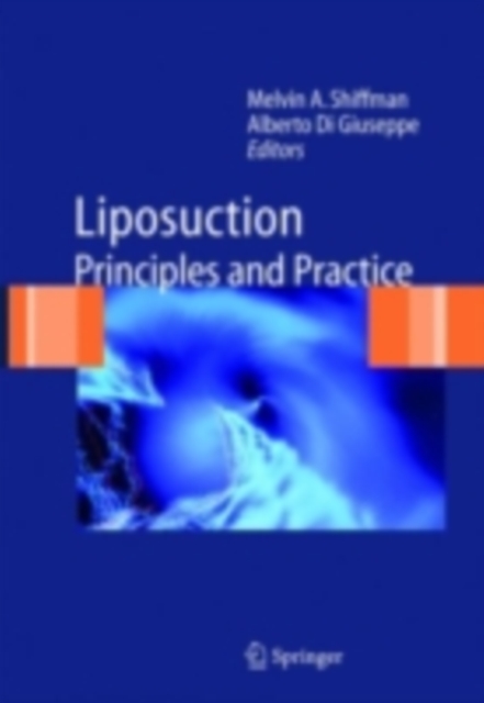 Liposuction : Principles and Practice, PDF eBook