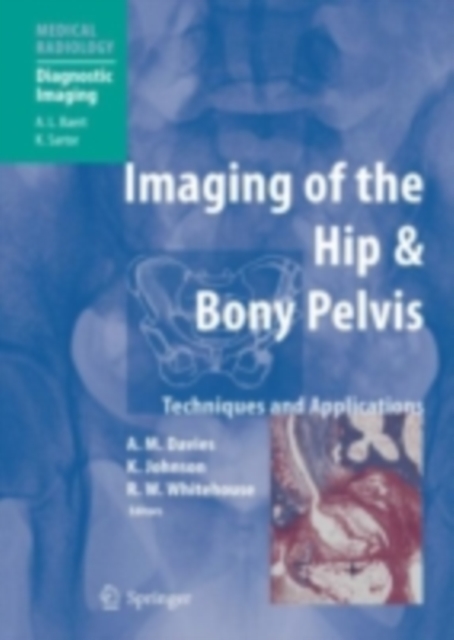 Imaging of the Hip & Bony Pelvis : Techniques and Applications, PDF eBook