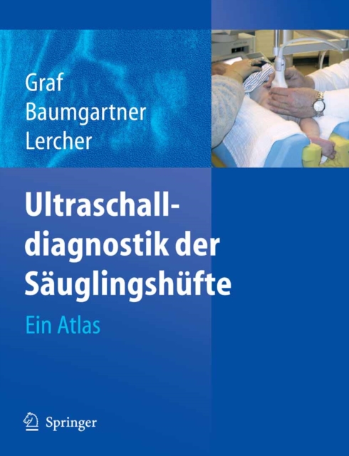 Ultraschalldiagnostik der Sauglingshufte : Ein Atlas, PDF eBook