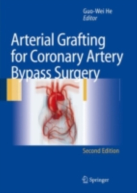 Arterial Grafting for Coronary Artery Bypass Surgery, PDF eBook