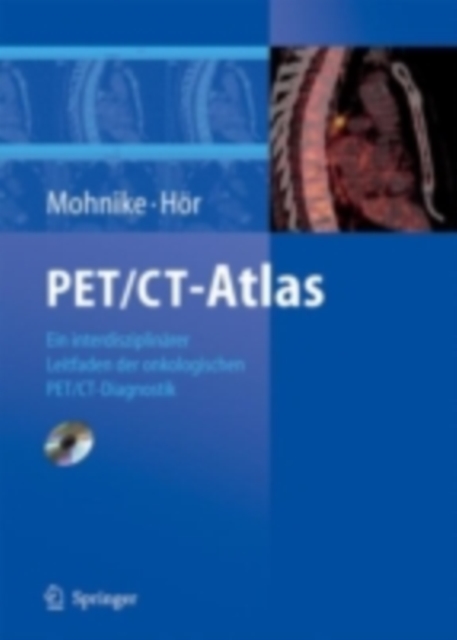 PET/CT-Atlas : Ein interdisziplinarer Leitfaden der onkologischen PET/CT-Diagnostik, PDF eBook