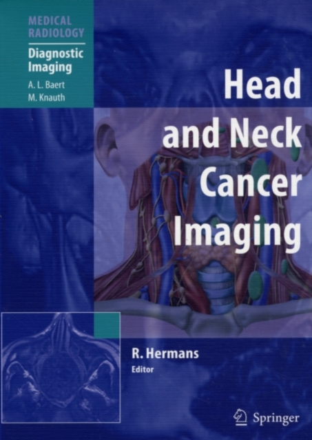 Head and Neck Cancer Imaging, PDF eBook