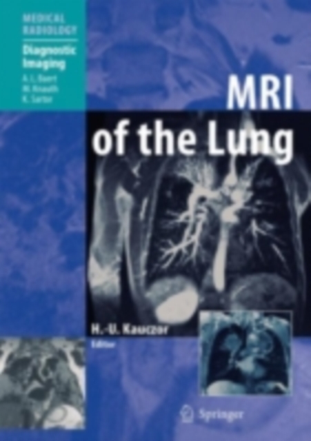 MRI of the Lung, PDF eBook