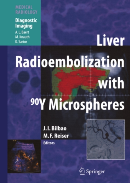Liver Radioembolization with 90Y Microspheres, PDF eBook