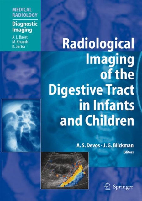 Radiological Imaging of the Digestive Tract in Infants and Children, Hardback Book