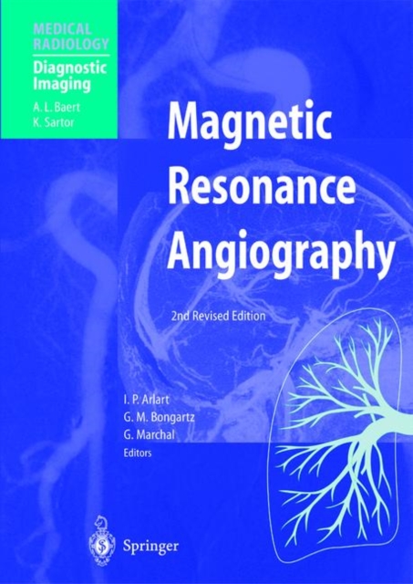 Magnetic Resonance Angiography, Paperback / softback Book