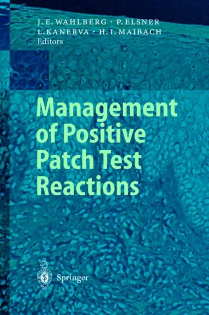 Management of Positive Patch Test Reactions, Paperback / softback Book
