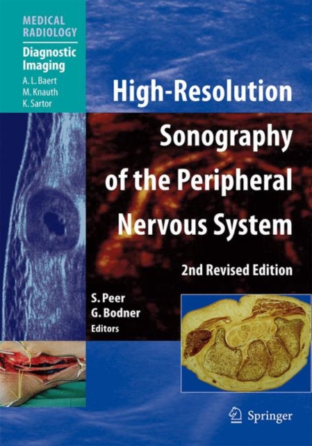 High-Resolution Sonography of the Peripheral Nervous System, Hardback Book