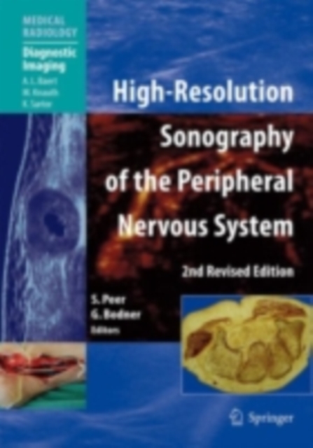 High-Resolution Sonography of the Peripheral Nervous System, PDF eBook
