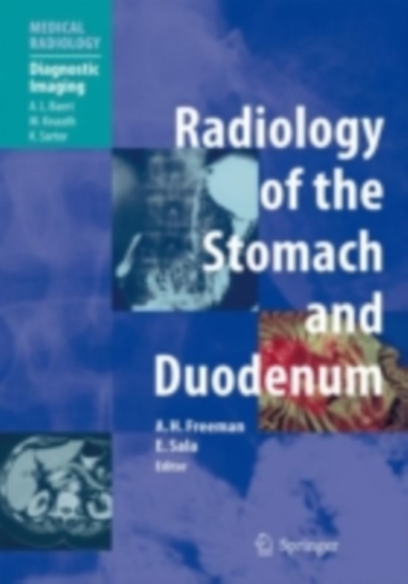 Radiology of the Stomach and Duodenum, PDF eBook