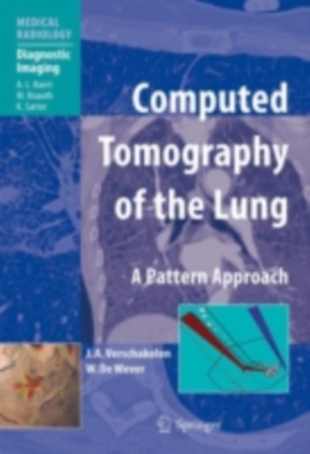 Computed Tomography of the Lung : A Pattern Approach, PDF eBook