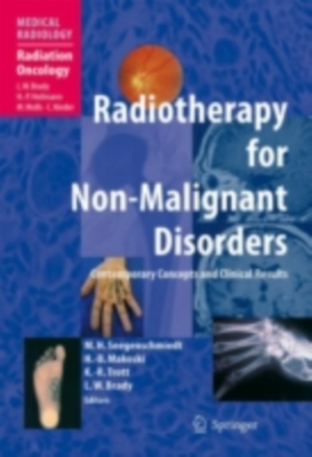Radiotherapy for Non-Malignant Disorders, PDF eBook