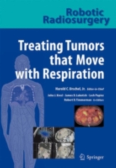 Robotic Radiosurgery. Treating Tumors that Move with Respiration, PDF eBook