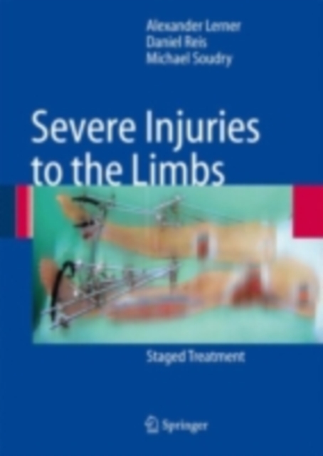 Severe Injuries to the Limbs : Staged Treatment, PDF eBook