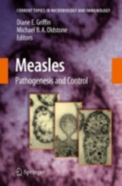 Measles : Pathogenesis and Control, PDF eBook