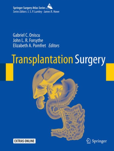 Transplantation Surgery, EPUB eBook