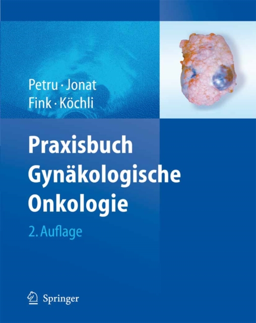Praxisbuch Gynakologische Onkologie, PDF eBook