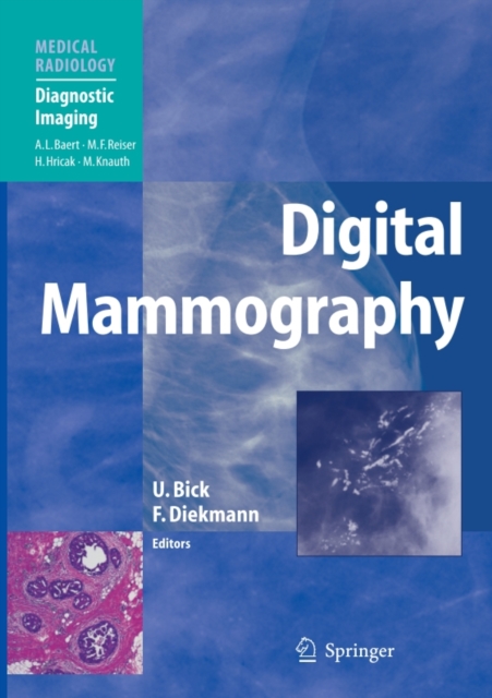 Digital Mammography, PDF eBook