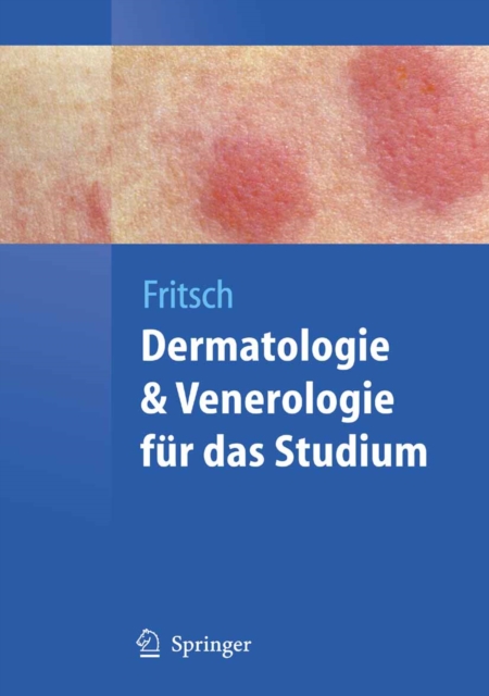 Dermatologie und Venerologie fur das Studium, PDF eBook