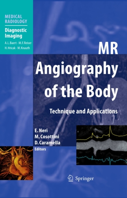 MR Angiography of the Body : Technique and Clinical Applications, PDF eBook