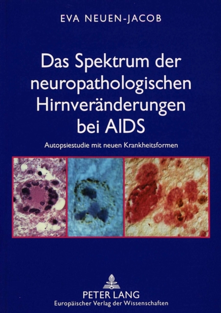 Das Spektrum der neuropathologischen Hirnveraenderungen bei AIDS : Autopsiestudie mit neuen Krankheitsformen, Paperback Book