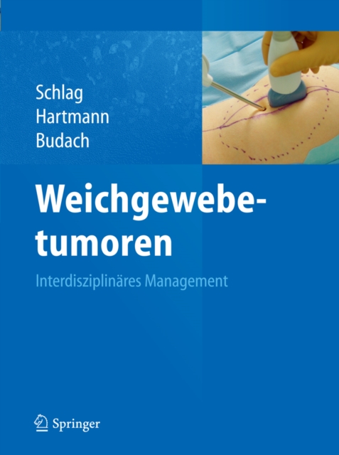 Weichgewebetumoren : Interdisziplinares Management, PDF eBook