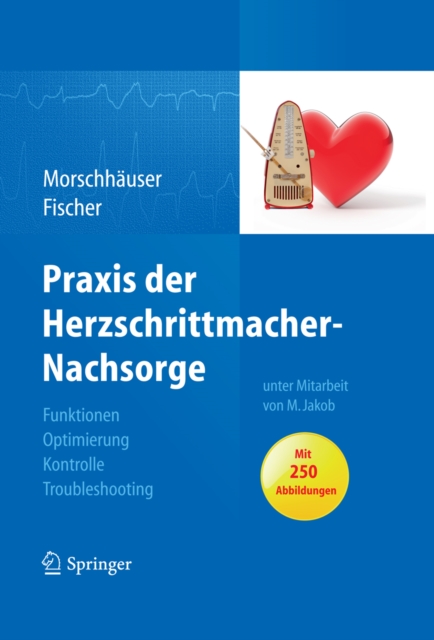 Praxis der Herzschrittmacher-Nachsorge : Grundlagen, Funktionen, Kontrolle, Optimierung, Troubleshooting, PDF eBook