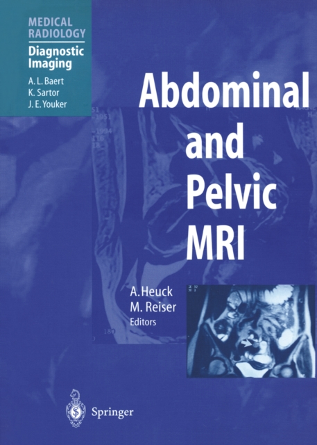 Abdominal and Pelvic MRI, PDF eBook