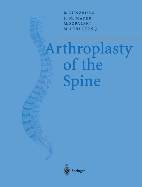 Arthroplasty of the Spine, PDF eBook