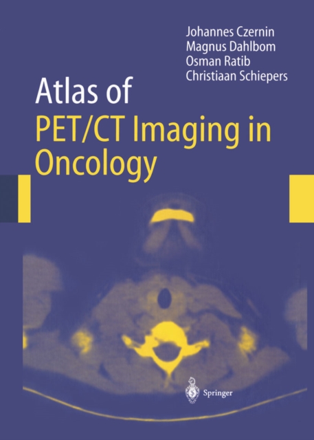 Atlas of PET/CT Imaging in Oncology, PDF eBook
