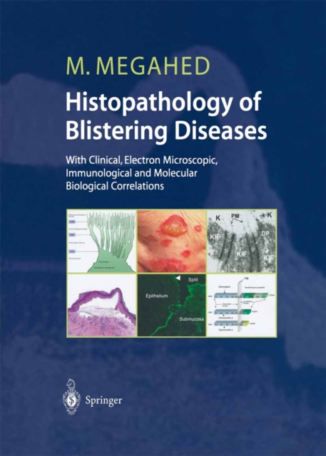 Histopathology of Blistering Diseases : With Clinical, Electron Microscopic, Immunological and Molecular Biological Correlations Textbook and Atlas, PDF eBook
